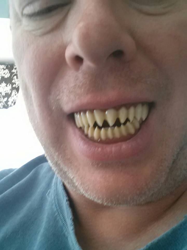 teeth_zpsd6a4b04e.jpg